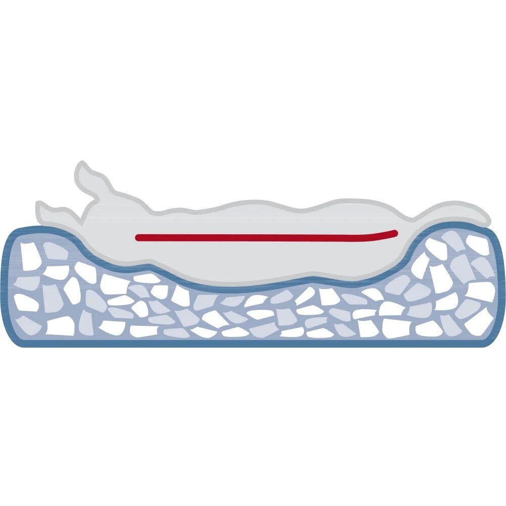 Iglu NOAH VITAL - Image 2